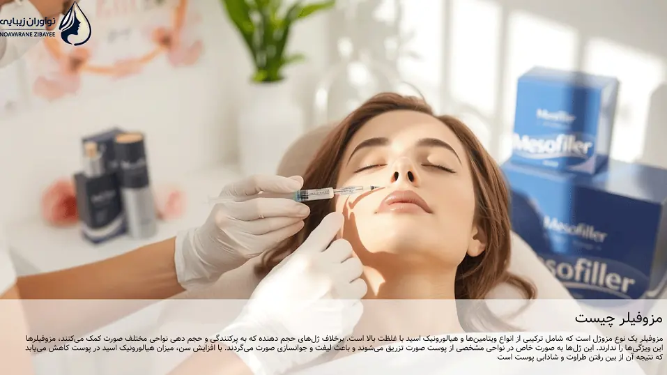 مزوفیلر چیست